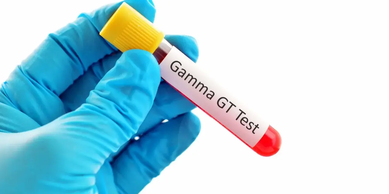 Ręka w niebieskiej rękawiczce trzyma probówkę z krwią do badania gamma glutamylotranspeptydazy (GGTP).
