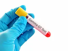 Ręka w niebieskiej rękawiczce trzyma probówkę z krwią do badania gamma glutamylotranspeptydazy (GGTP).