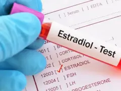 Ręka w niebieskiej rękawiczce trzyma probówkę z napisem "Estradiol - Test" na tle dokumentu z zaznaczonym badaniem estradiolu. Sprawdzanie estradiol normy.