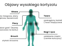 Objawy wysokiego kortyzolu: mgła mózgowa, "wdowi garb", otyłość brzuszna, okrągła twarz, osłabienie mięśni.