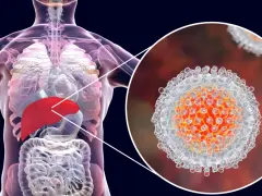 Wirus hcv atakuje wątrobę, która jest podświetlona na czerwono. Widok powiększony ukazuje strukturę wirusa.