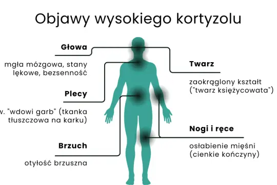 Objawy wysokiego kortyzolu: mgła mózgowa, "wdowi garb", otyłość brzuszna, okrągła twarz, osłabienie mięśni.